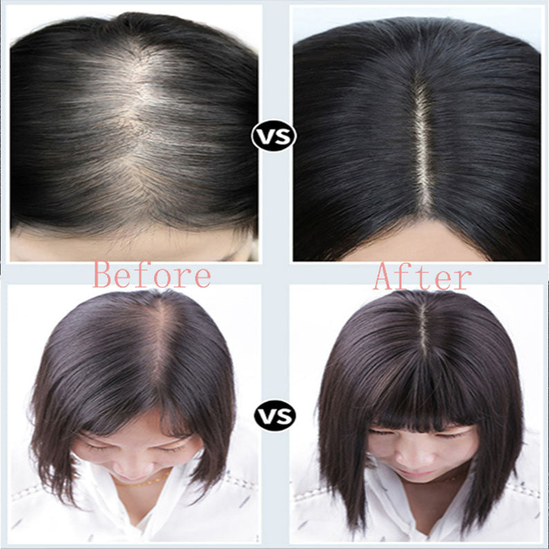 No glue Hairline Toupee For Women (Real hair)